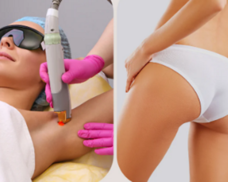 Depilación Láser Axilas y Full Brazilian (6 sesiones)
