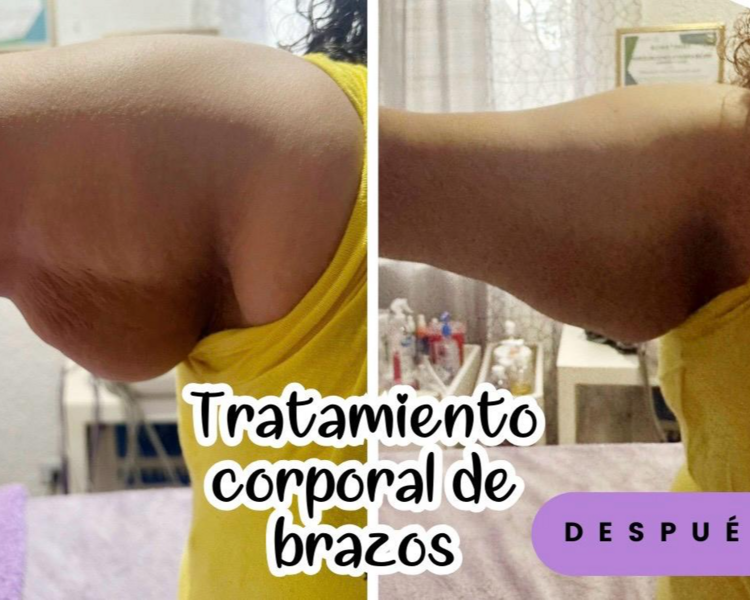 LIPOBRAZOS PROMO