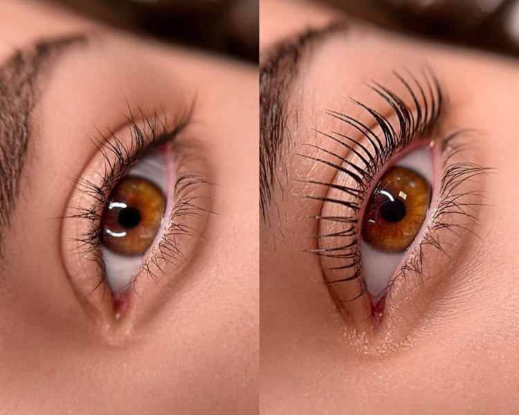 Lifting de pestañas 