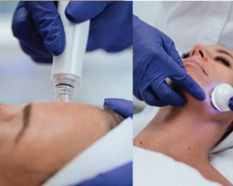 ONA by INDIBA 1 SESIÓN