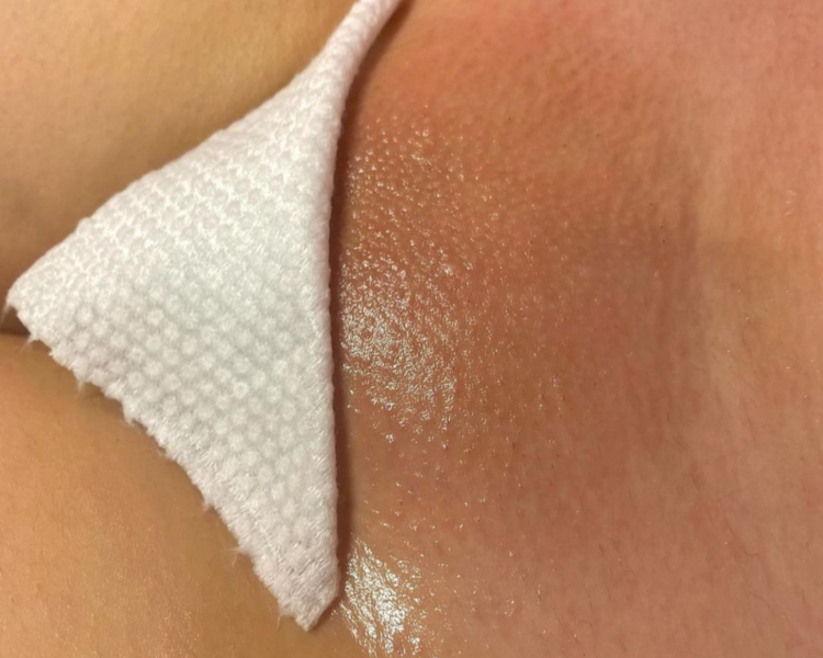 DEPILACIÓN BRASILEÑA