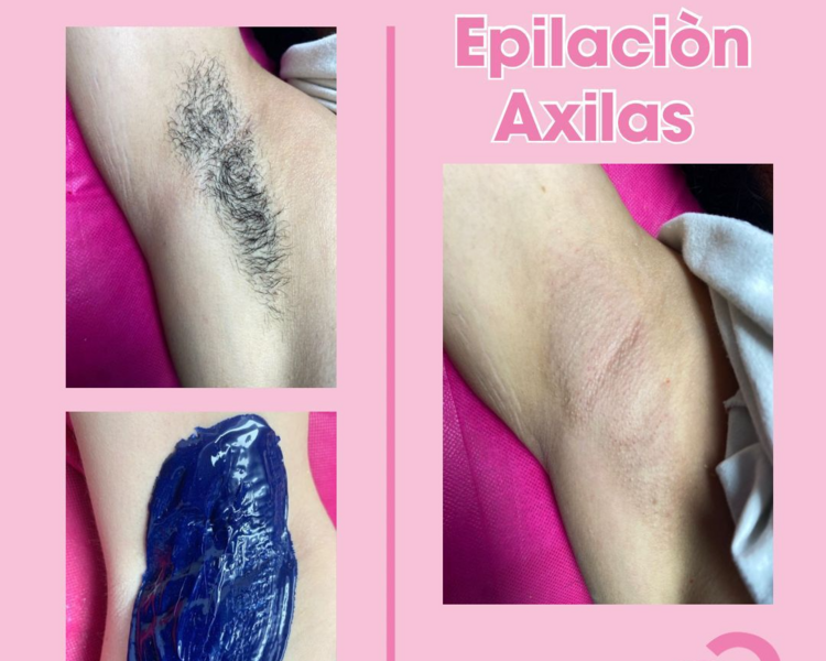 DEPILACIÓN AXILAS 