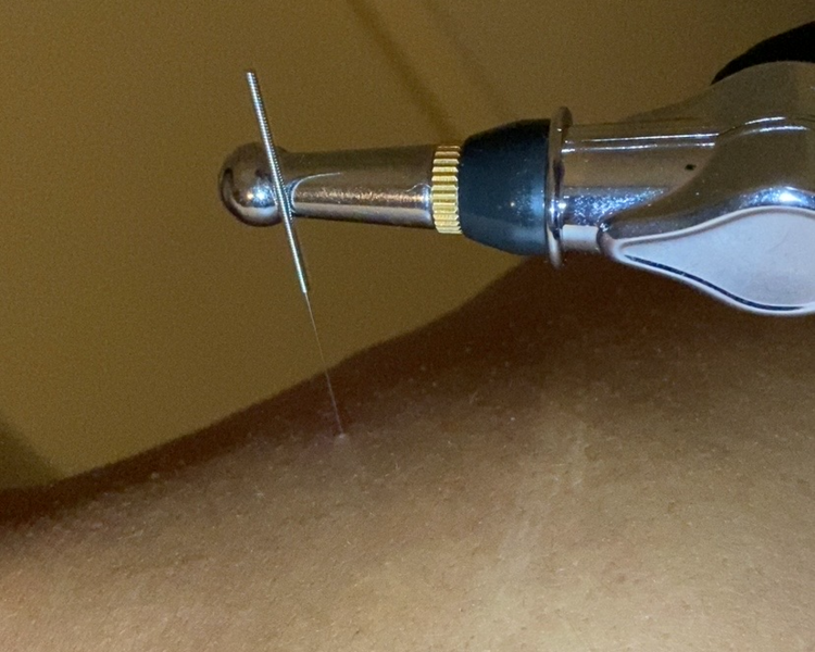 Masajes Descontracturantes + puncion seca
