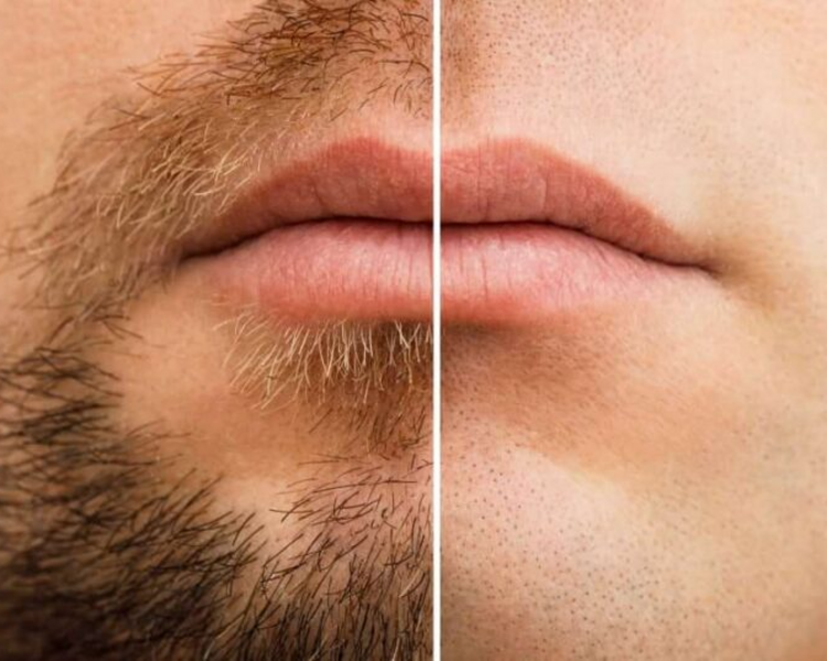 Rasurado Completo Barba