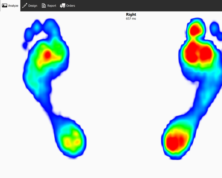 Footscan deportivo ( Biomecánica de la pisada para deportistas)