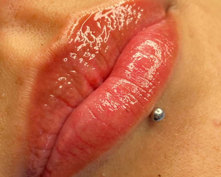 HidraLips