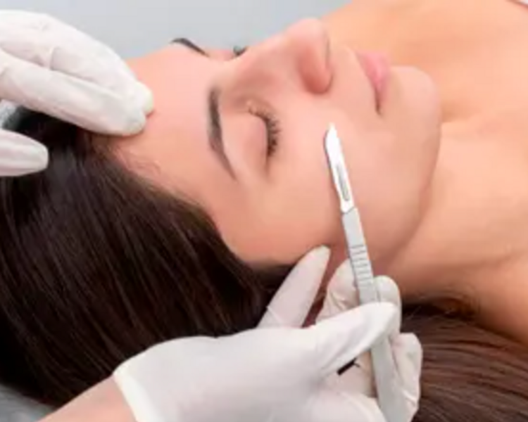 Dermaplaning + Peeling Decapage rostro, cuello y escote
