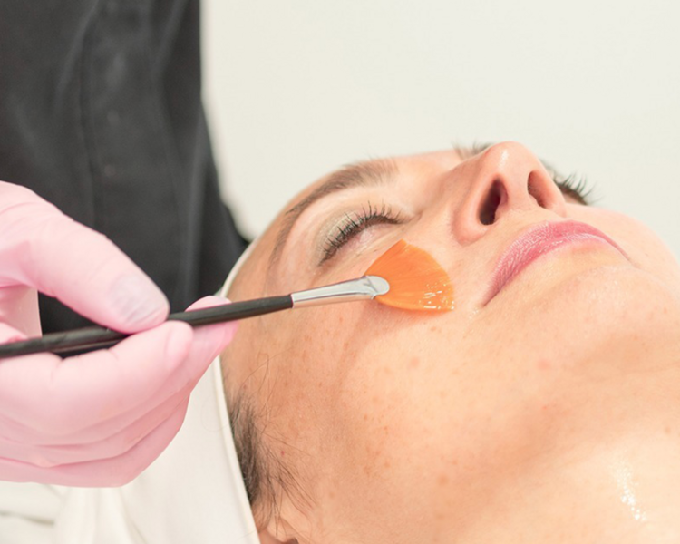 Peeling Fuerte DECAPAGE rostro