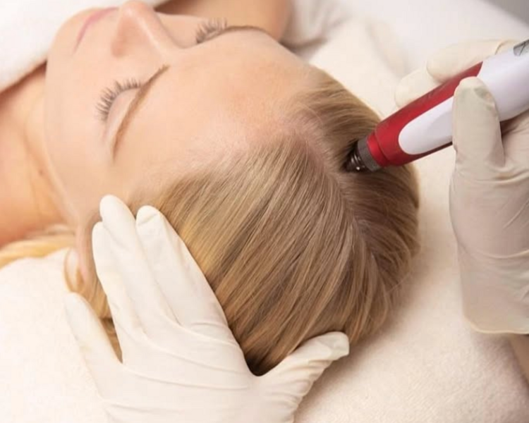 Dermapen Capilar