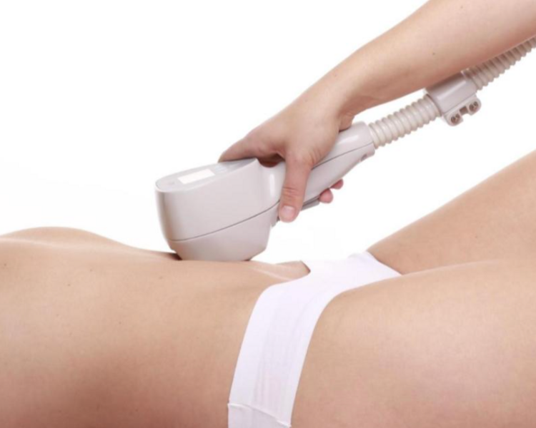 HIFU Abdomen + Gluteos 