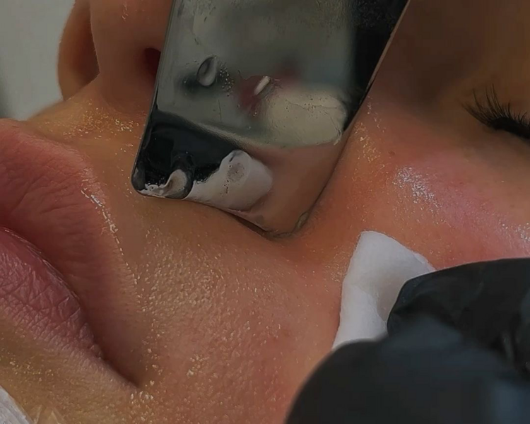 Limpieza facial profunda 