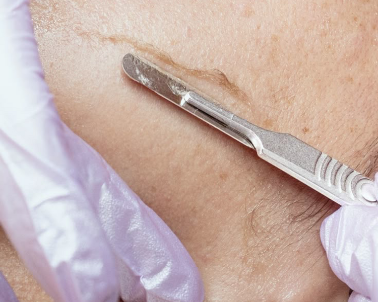 DERMAPLANING+Limpieza facial 