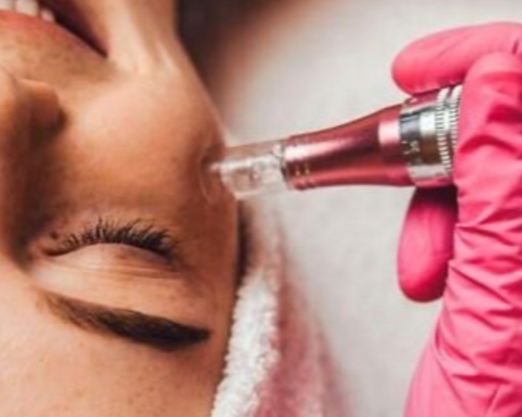 DERMAPEN+Limpieza facial