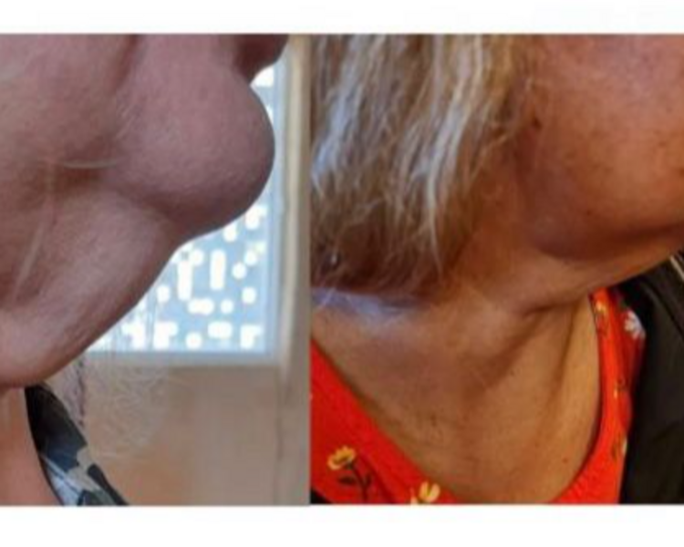 LIPOPAPADA ENZYMAS PROMO