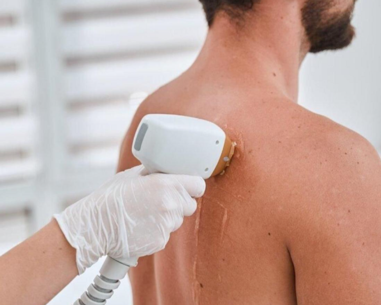 Espalda completa hombre 