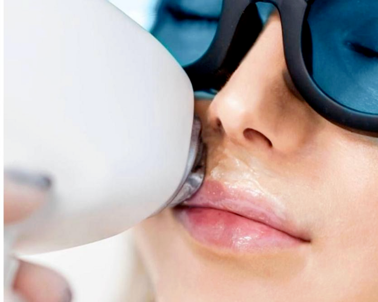 patilla, mejilla, pomulo