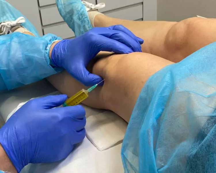 Plasma rico en Plaquetas