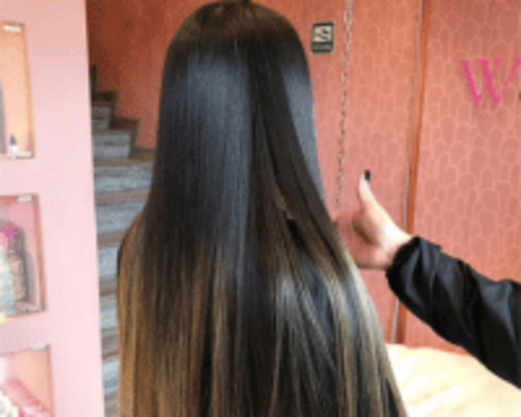 Cirugía Capilar Clásica ¡Nuestro TOP Seller desde 2016!