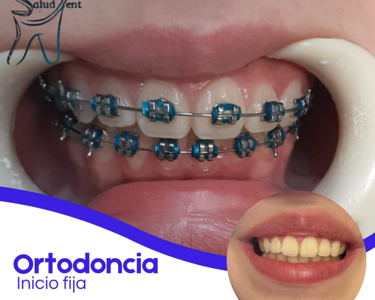 Evaluacion Ortodoncia /Adulto e Infantil 