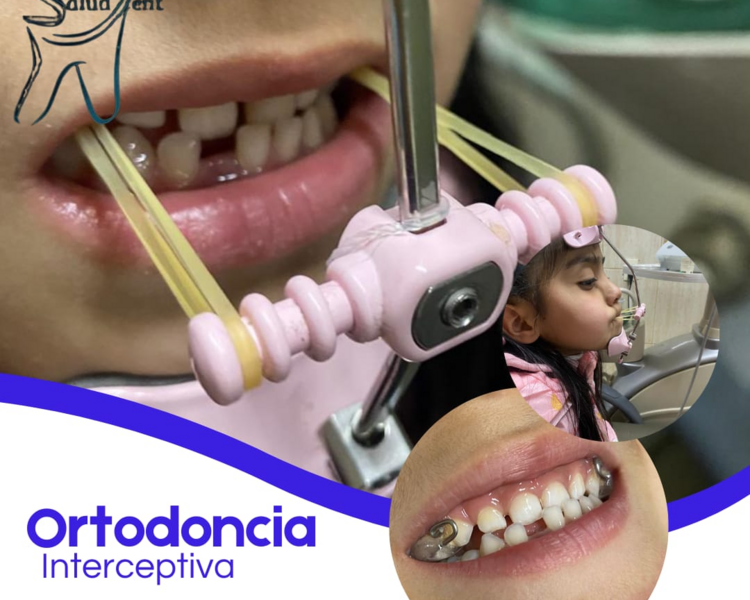 Ortodoncia Preventiva Niños