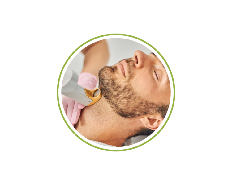 10 Sesiones Depilación OPT Barba Caballero