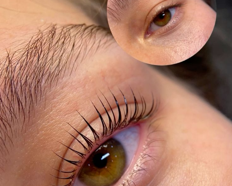 Lash lifting 