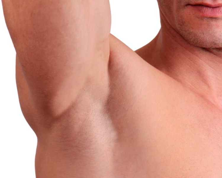 Despigmentación de axilas