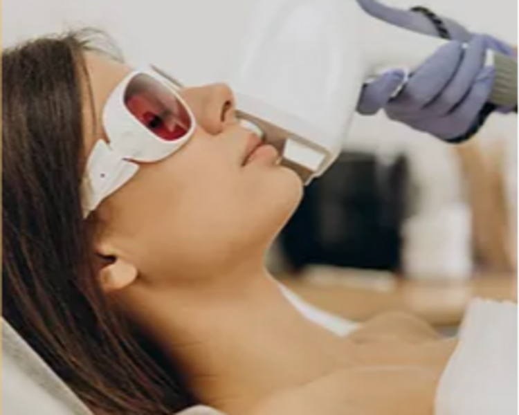 Difuminación de manchas