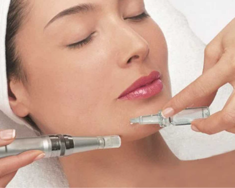 Dermapen facial ( 3 sesiónes)