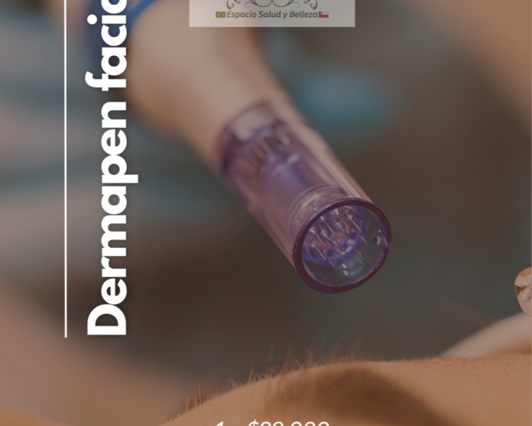 Dermapen facial ( 3 sesiónes)