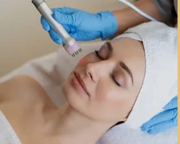 Fototerapia Anti-Acné