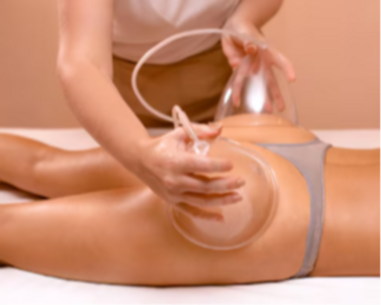 Vacumterapia Gluteo