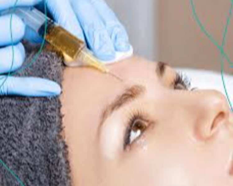 3 Sesiones Plasma Rico en Plaqueta (Rejuvenecimiento Facial) 