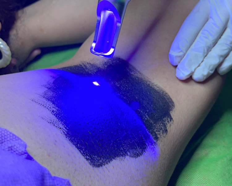 Hollywood Peel Coporal 