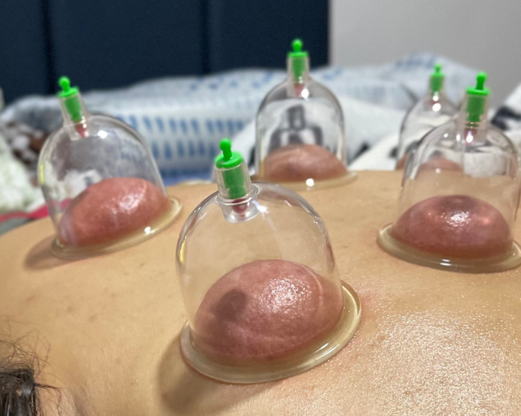 Masaje Relajante con Ventosas