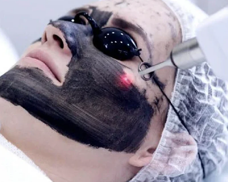 Hollywood Peel Facial