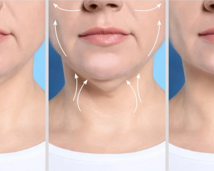 Lipopapada Enzimática