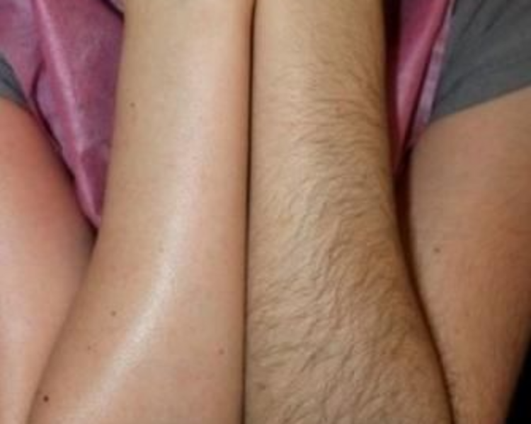 DEPILACION BRAZOS - CERA