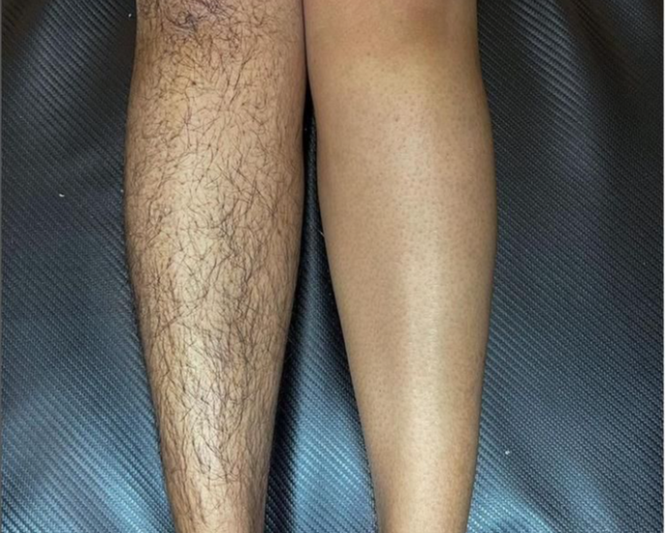 DEPILACION PIERNAS - CERA