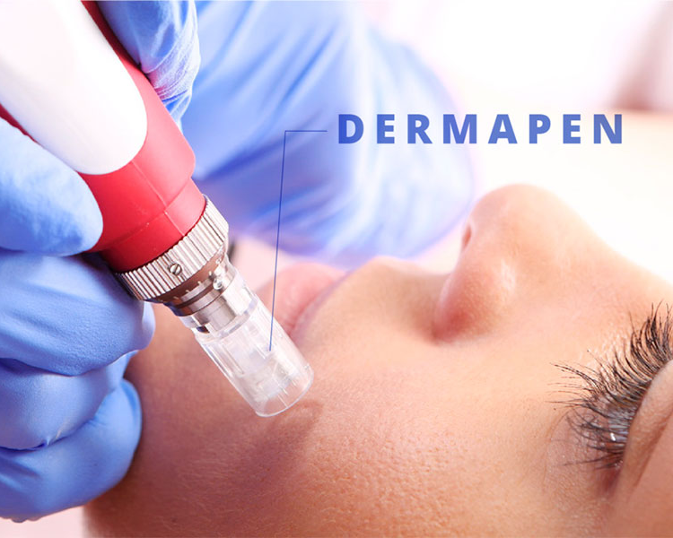 MICRONEEDLING/ DERMAPEN FACIAL
