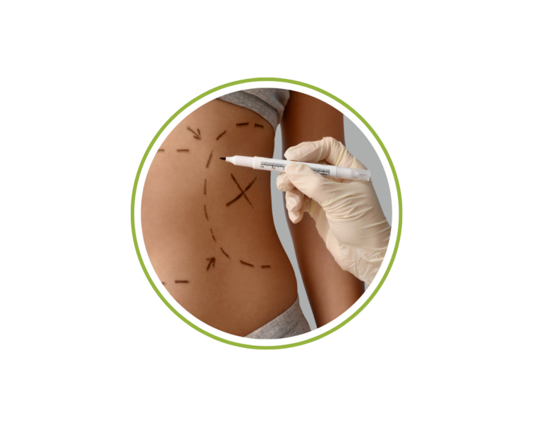 10 Sesiones Masaje Posoperatorio Lipoescultura