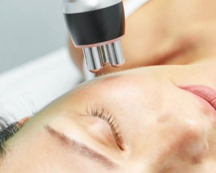 RADIOFRECUENCIA FACIAL: Trio Polar