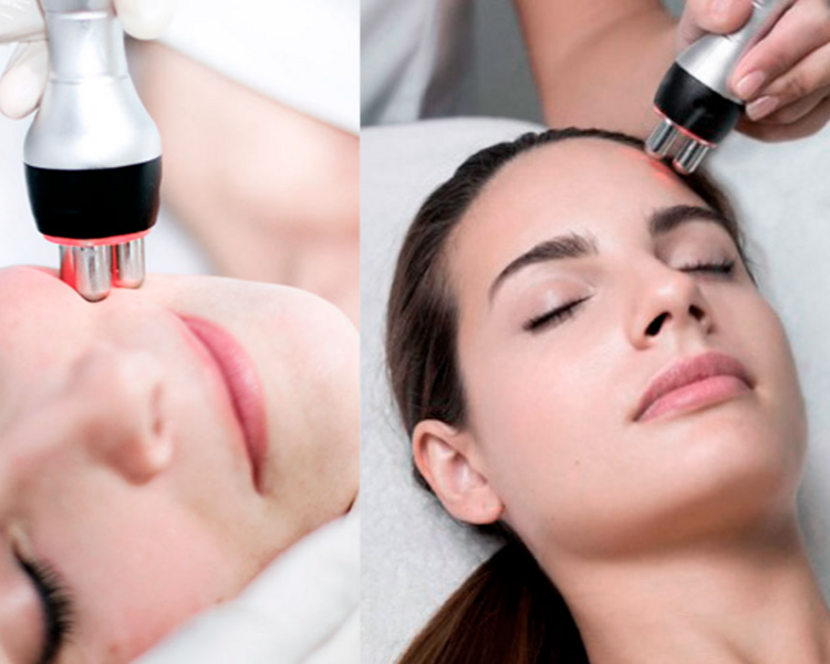 RADIOFRECUENCIA FACIAL: Trio Polar