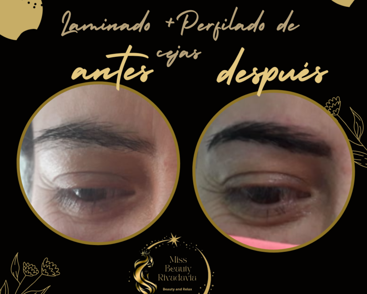 Lifting de cejas y perfilado