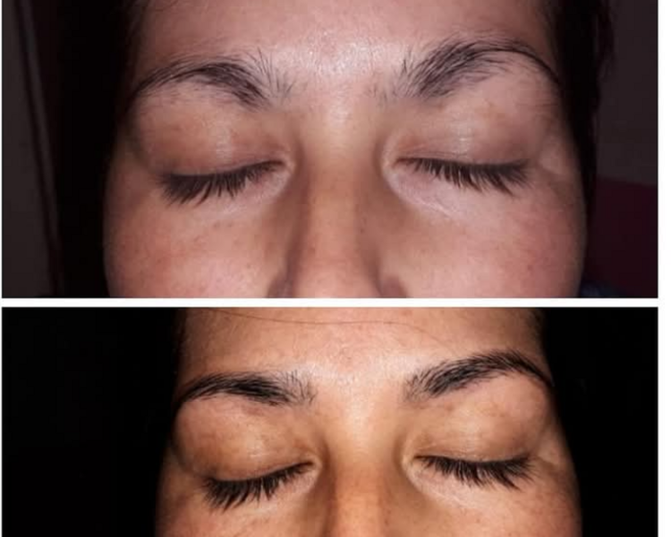 Lifting de cejas y perfilado