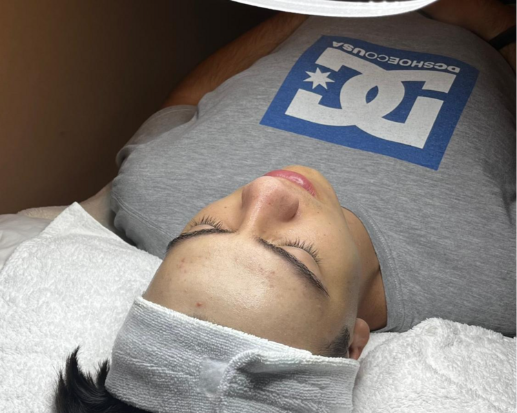 Limpieza Facial Adolescente 