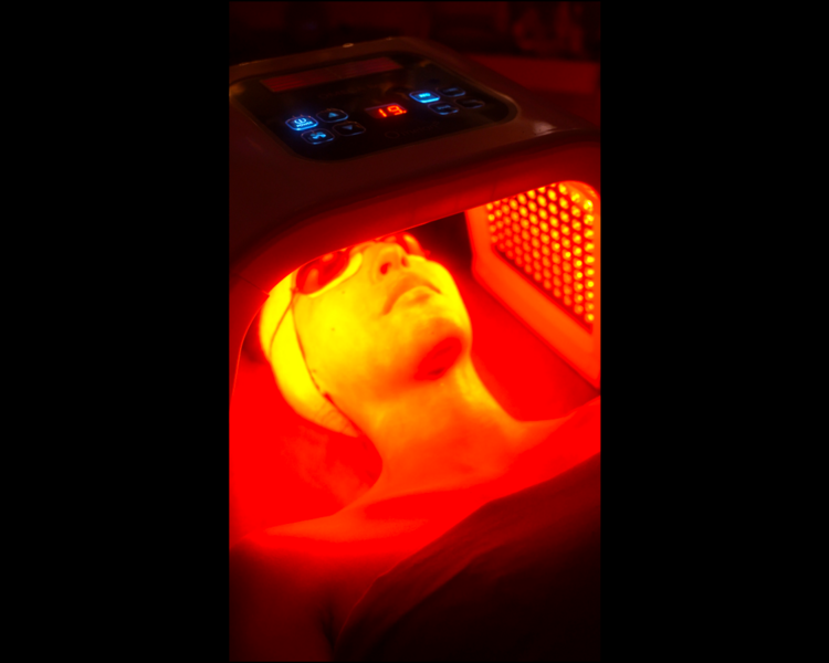 Facial Personalizado