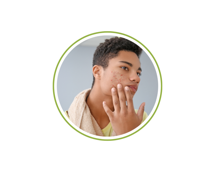 Facial de Limpieza Profunda para Adolescentes
