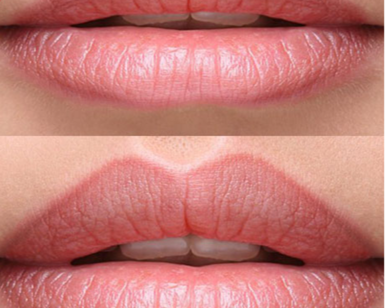 Delineado de Labios Permanente 
