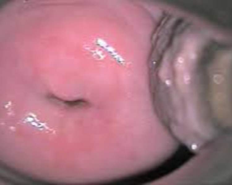 Paquete Health (Colposcopia+Citologia cervical+Consulta+ Rastreo Ultrasonido Vaginal y o Pelvico)